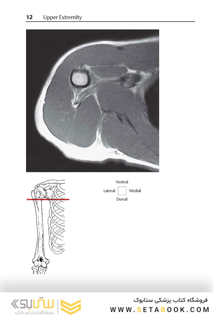 Pocket Atlas of Sectional Anatomy, Volume III, 2nd Edition 2017