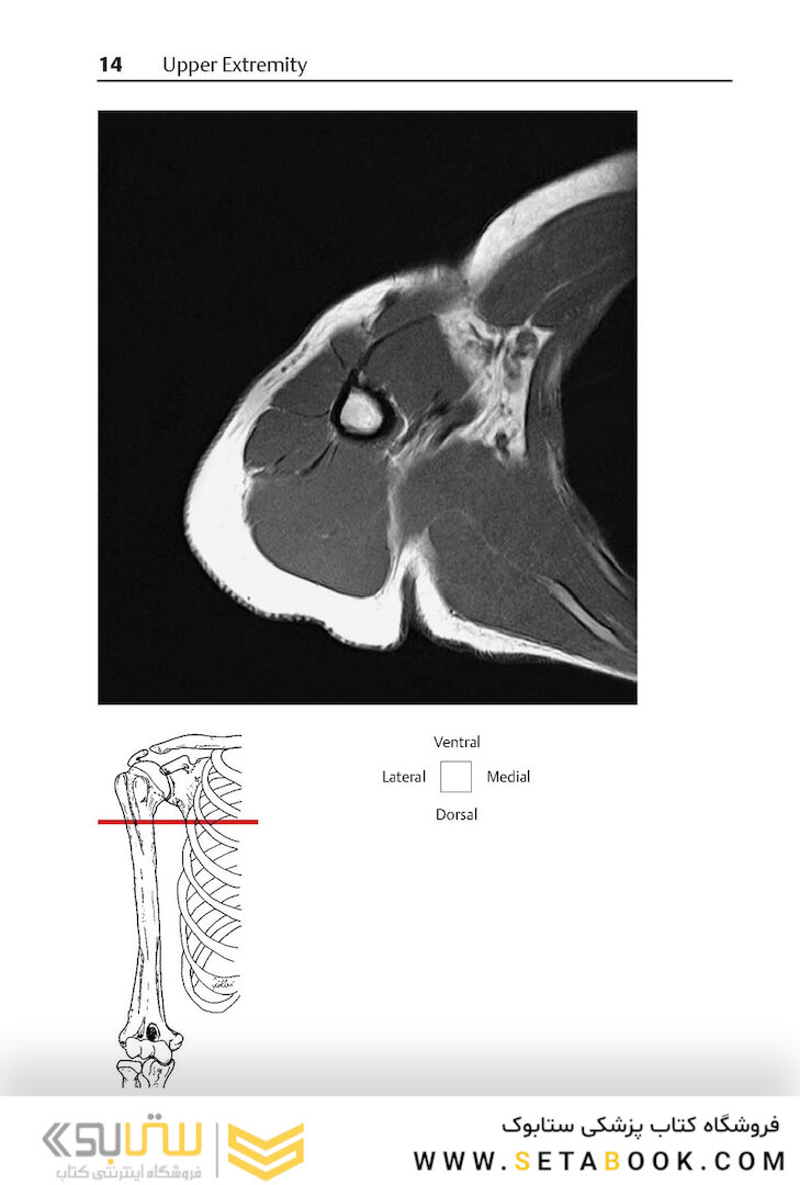 Pocket Atlas of Sectional Anatomy, Volume III, 2nd Edition 2017