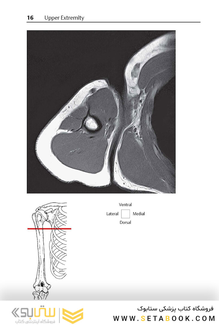 Pocket Atlas of Sectional Anatomy, Volume III, 2nd Edition 2017