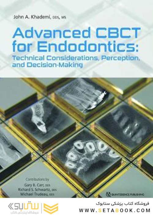 Advanced CBCT for Endodontics: Technical Considerations, Perception, and Decision-Making2017 CBCT