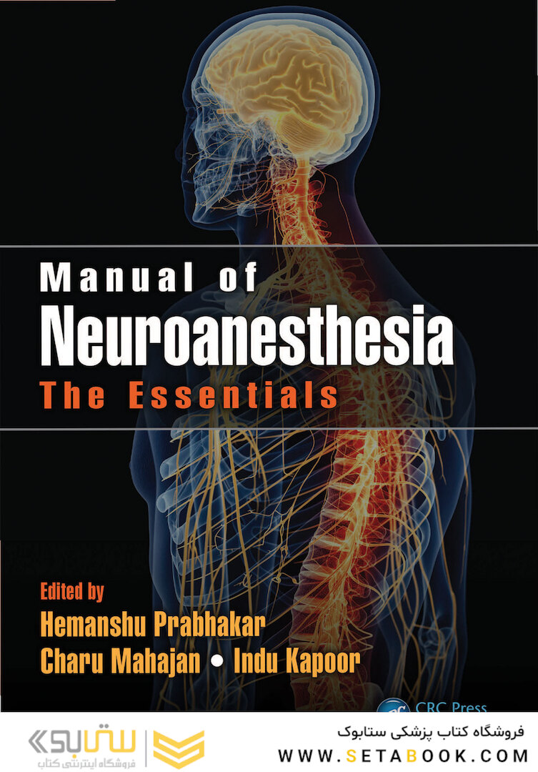 Manual of Neuroanesthesia: The Essentials 1st Edition2017