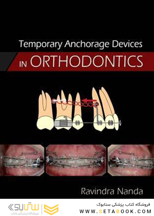Temporary Anchorage Devices in Orthodontics, 1st Edition2008 دستگاه های لنگر موقت در ارتودنسی