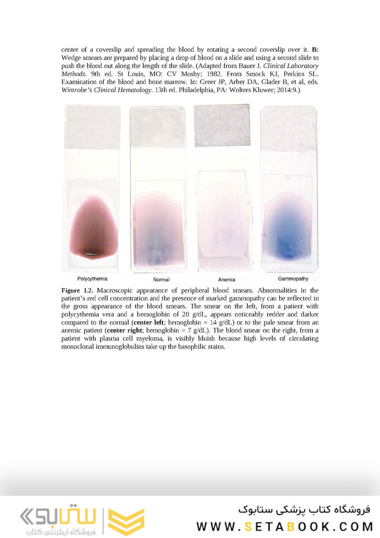 Wintrobe’s Atlas of Clinical Hematology, 2th Edition 2017