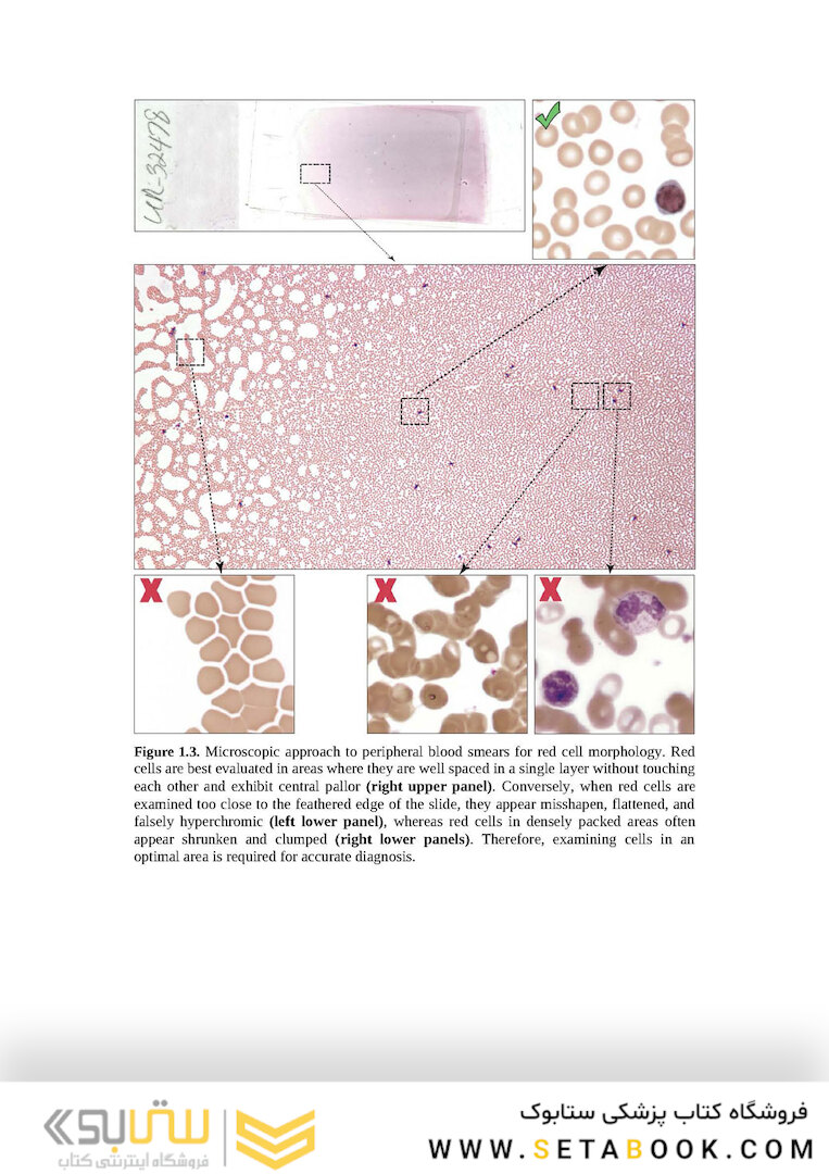 Wintrobe’s Atlas of Clinical Hematology, 2th Edition 2017