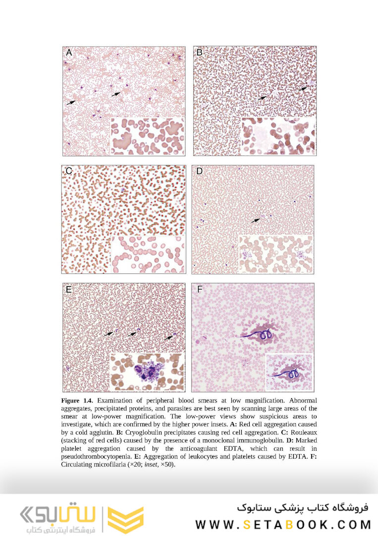 Wintrobe’s Atlas of Clinical Hematology, 2th Edition 2017