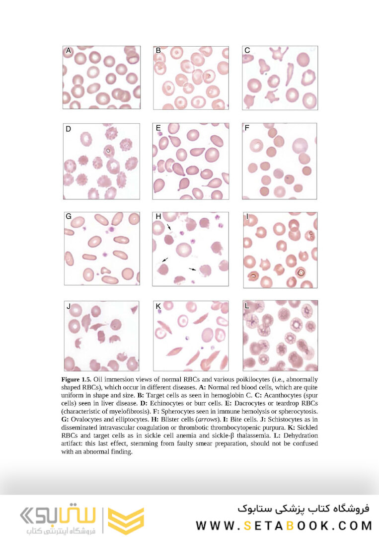 Wintrobe’s Atlas of Clinical Hematology, 2th Edition 2017
