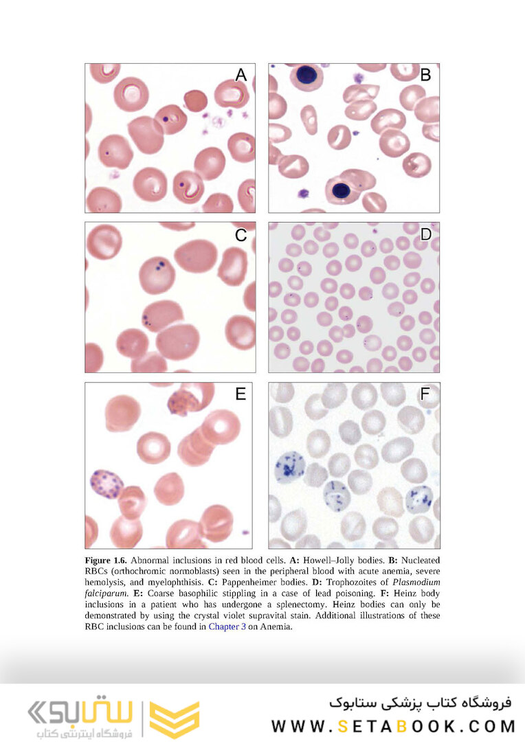 Wintrobe’s Atlas of Clinical Hematology, 2th Edition 2017