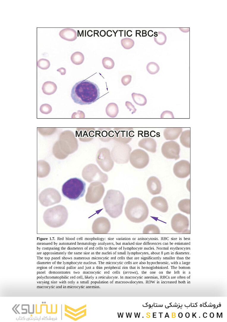Wintrobe’s Atlas of Clinical Hematology, 2th Edition 2017