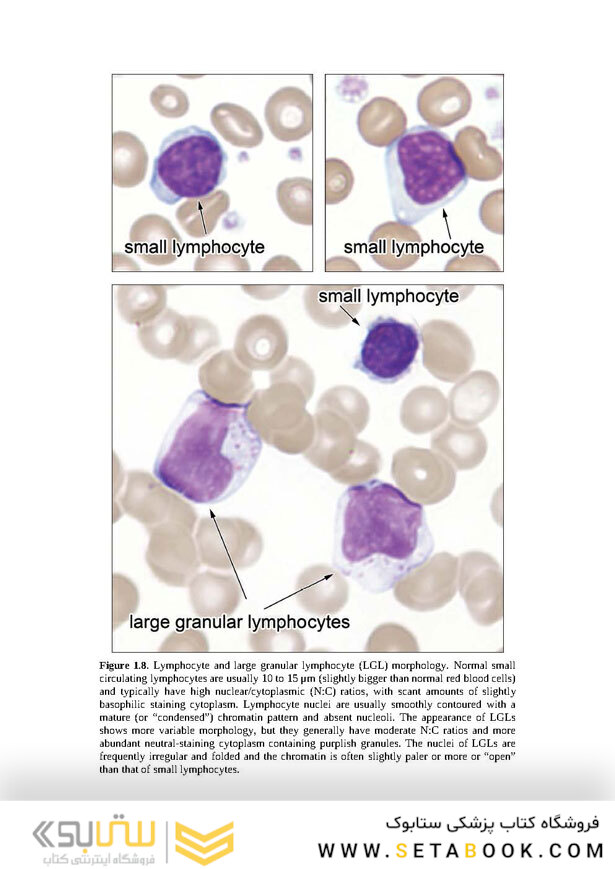 Wintrobe’s Atlas of Clinical Hematology, 2th Edition 2017