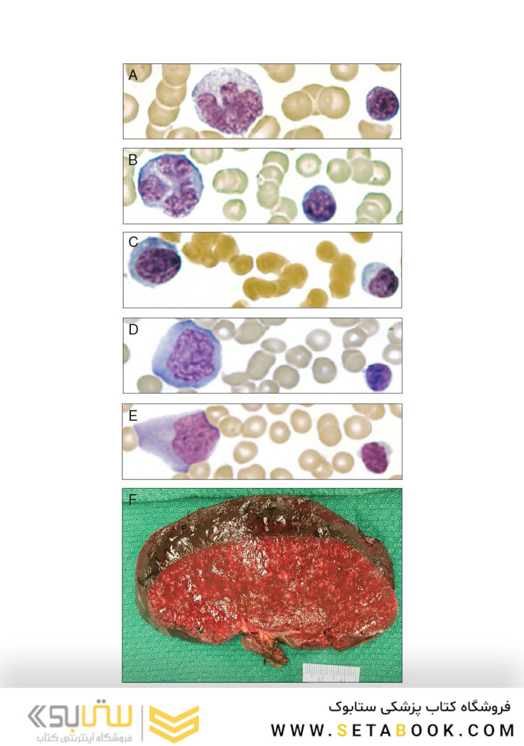 Wintrobe’s Atlas of Clinical Hematology, 2th Edition 2017