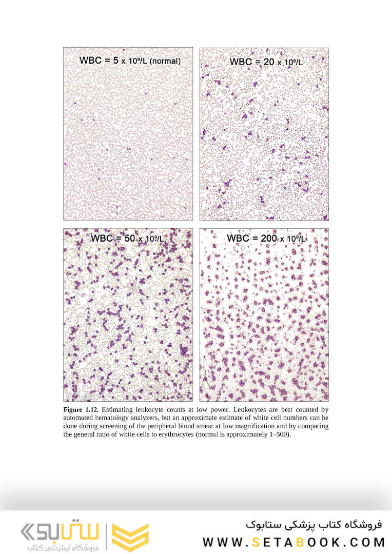 Wintrobe’s Atlas of Clinical Hematology, 2th Edition 2017