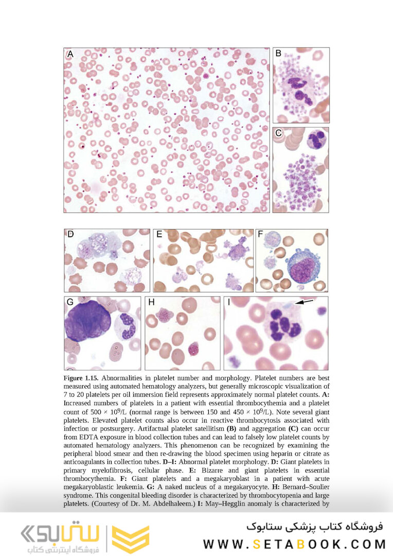 Wintrobe’s Atlas of Clinical Hematology, 2th Edition 2017