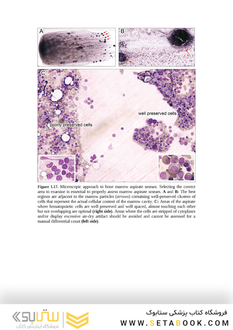 Wintrobe’s Atlas of Clinical Hematology, 2th Edition 2017