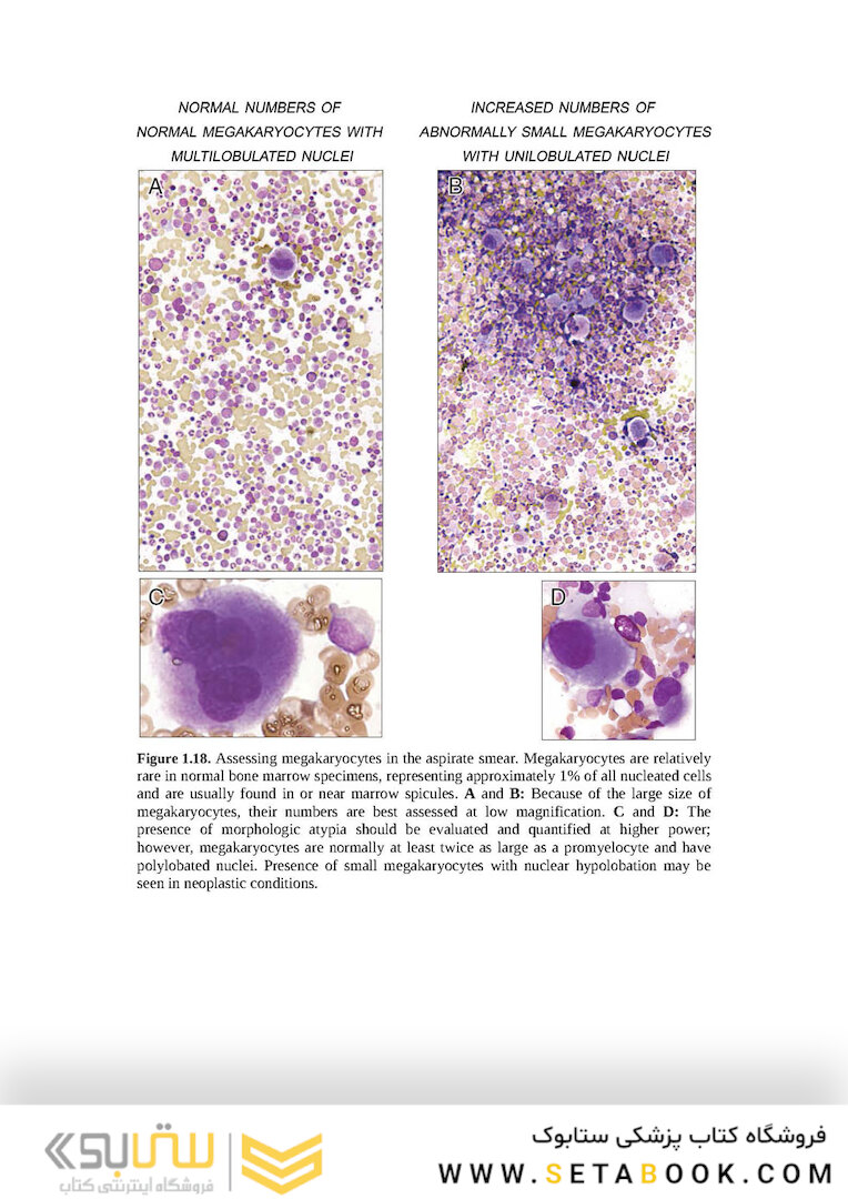 Wintrobe’s Atlas of Clinical Hematology, 2th Edition 2017