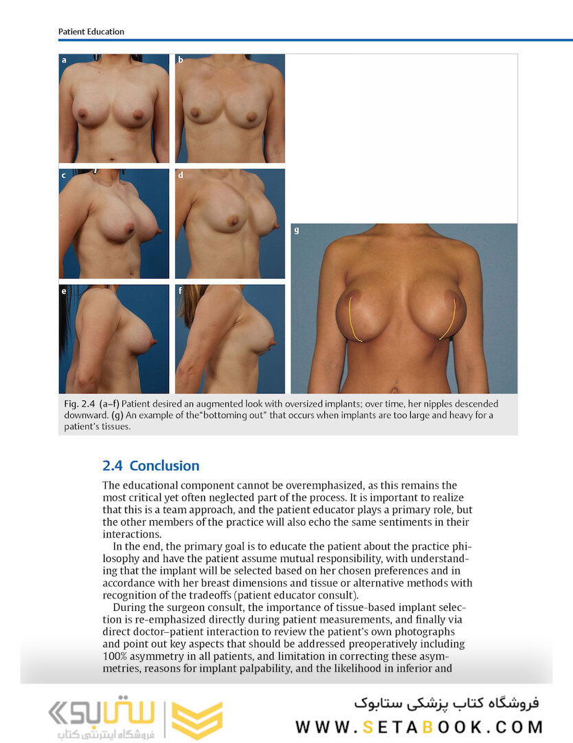 Breast Augmentation Video Atlas, 2nd Edition 2019