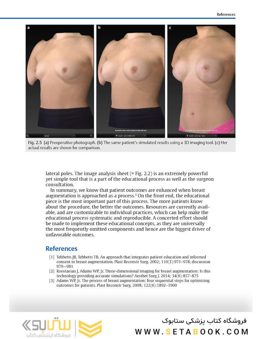 Breast Augmentation Video Atlas, 2nd Edition 2019