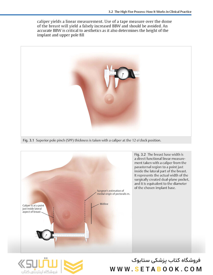 Breast Augmentation Video Atlas, 2nd Edition 2019