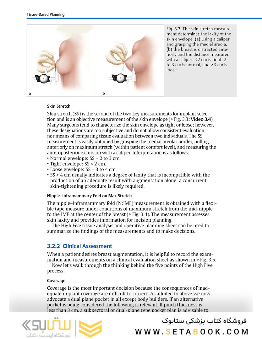Breast Augmentation Video Atlas, 2nd Edition 2019