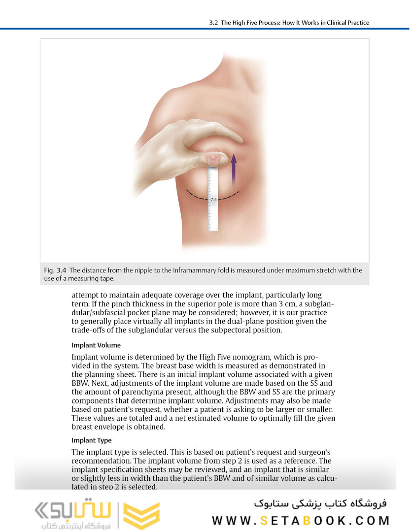 Breast Augmentation Video Atlas, 2nd Edition 2019