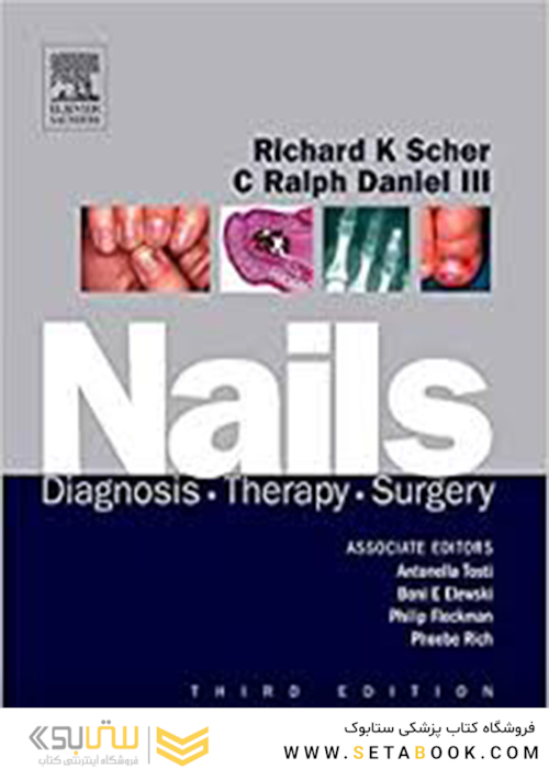 Nails: Diagnosis, Therapy, Surgery 3rd Edition2005
