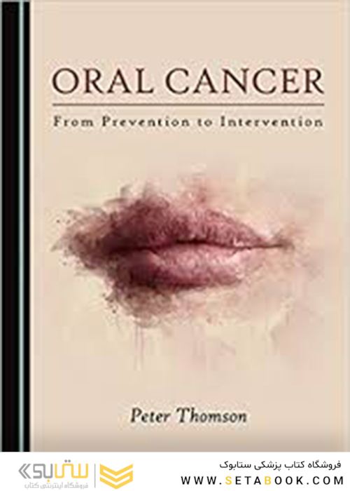 Oral Cancer, 1st Edition2019 سرطان دهان