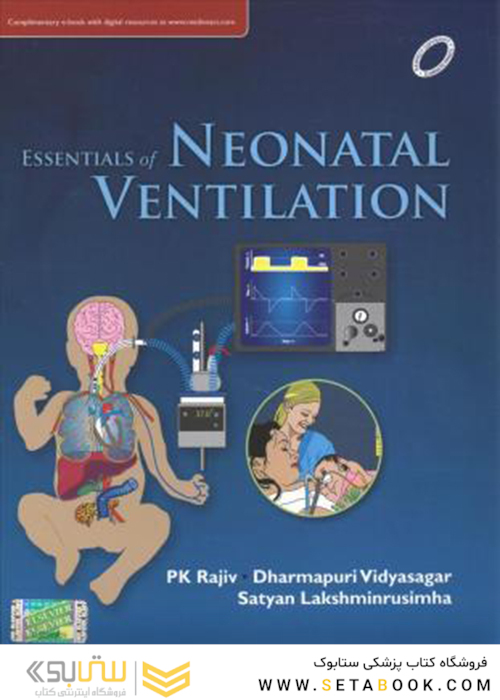 Essentials of Neonatal Ventilation, 1st Edition2019