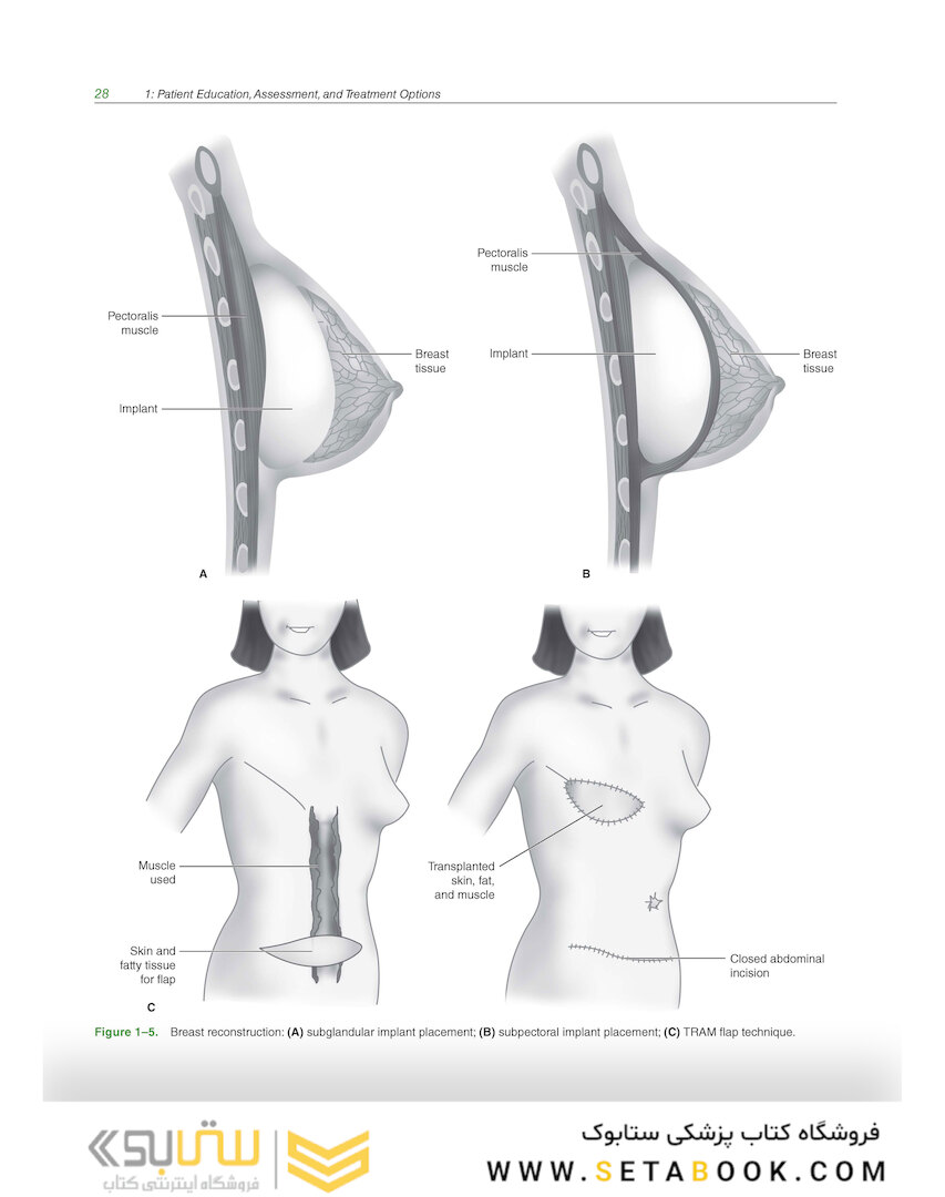 LANGE Q-A: Mammography Examination, 5th Edition 2022