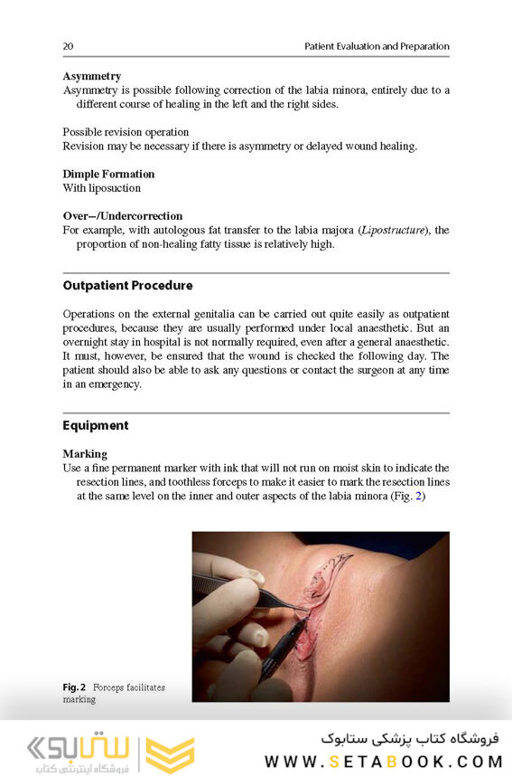 Aesthetic and Functional Labiaplasty 2018