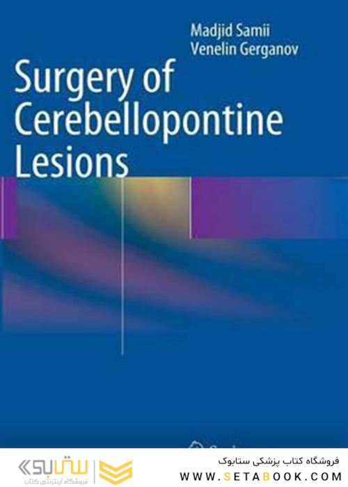 Surgery of Cerebellopontine Lesions2013 جراحی ضایعات