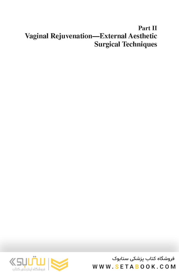 Aesthetic Vaginal Plastic Surgery 1st Edition2019