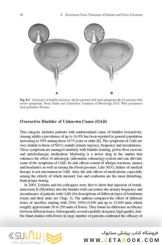 Botulinum Toxin Treatment: What Everyone Should Know