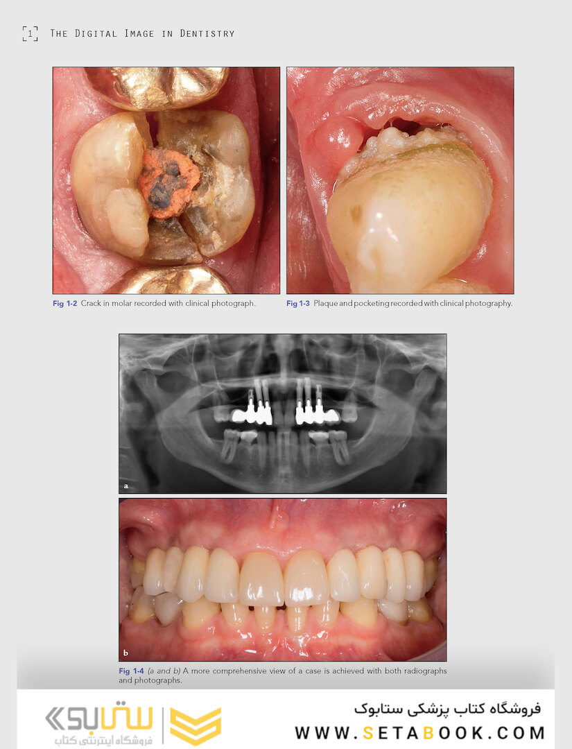 Clinical Photography in Dentistry 1st Edition 2019