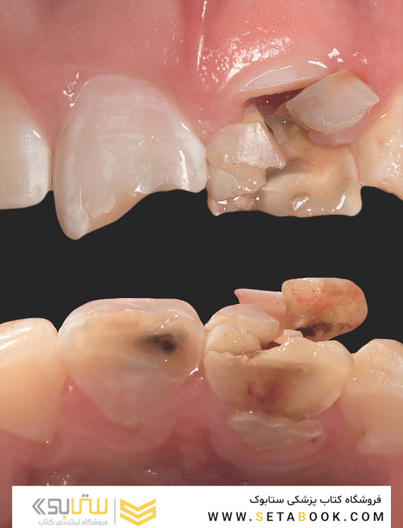 Clinical Photography in Dentistry 1st Edition 2019