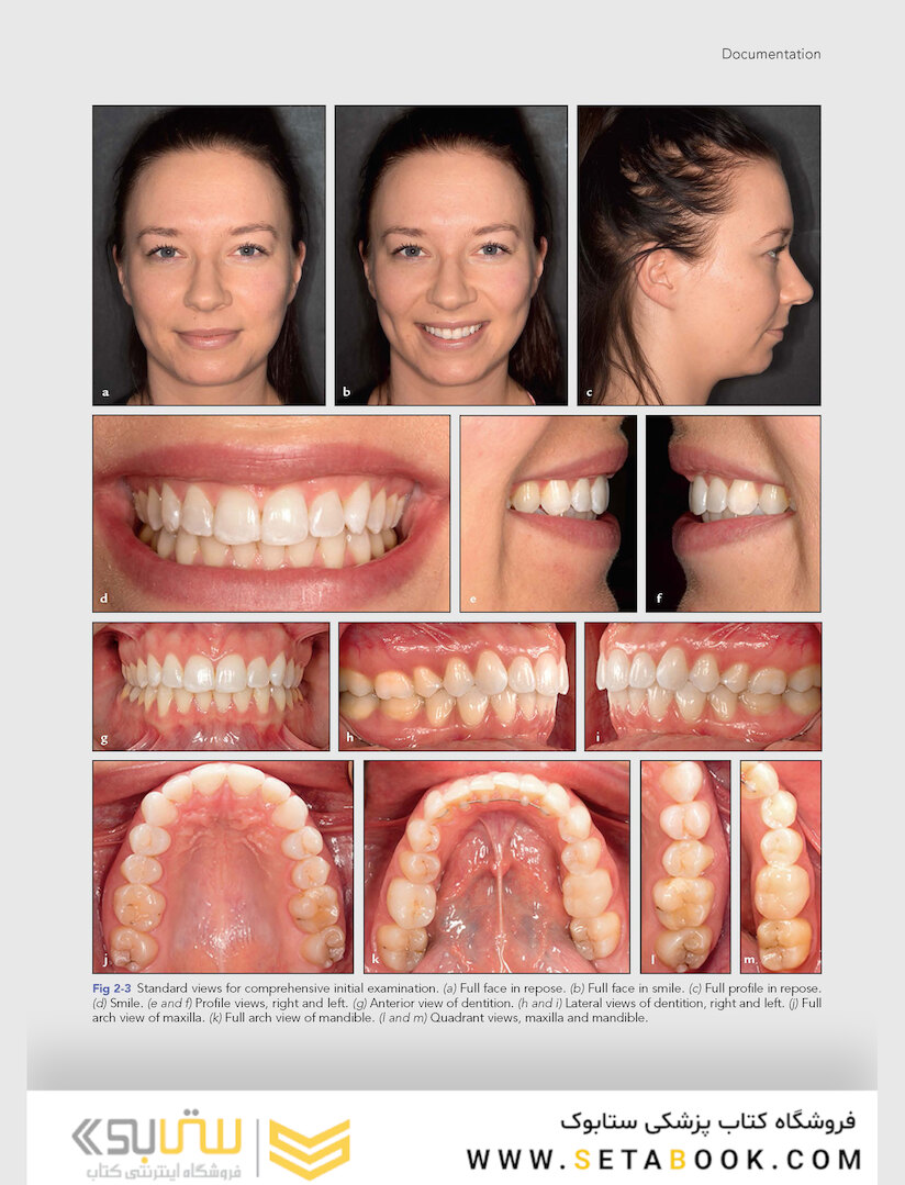 Clinical Photography in Dentistry 1st Edition 2019