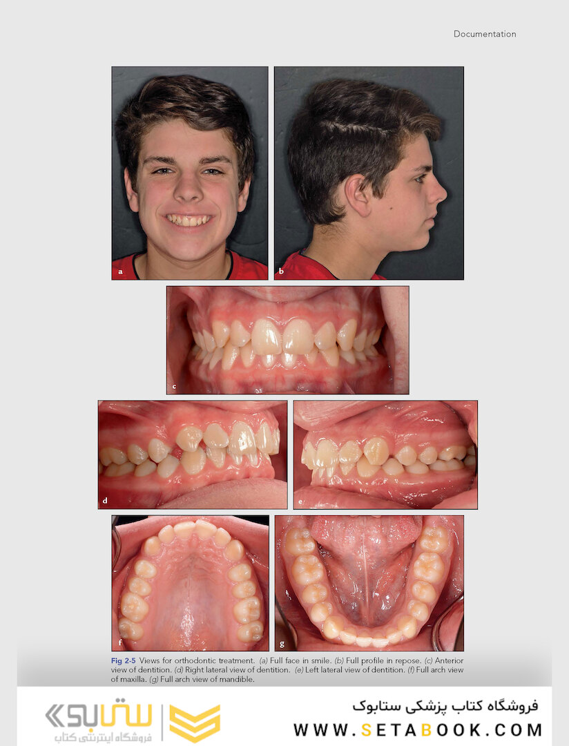 Clinical Photography in Dentistry 1st Edition 2019