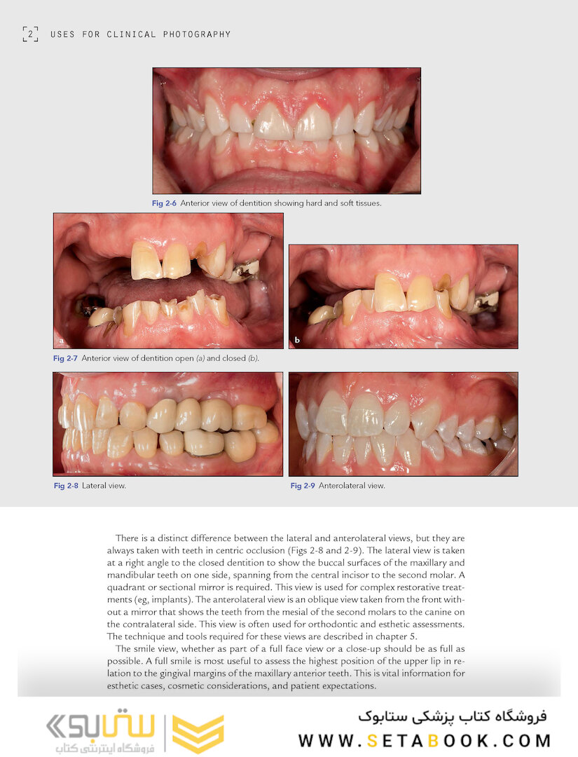 Clinical Photography in Dentistry 1st Edition 2019
