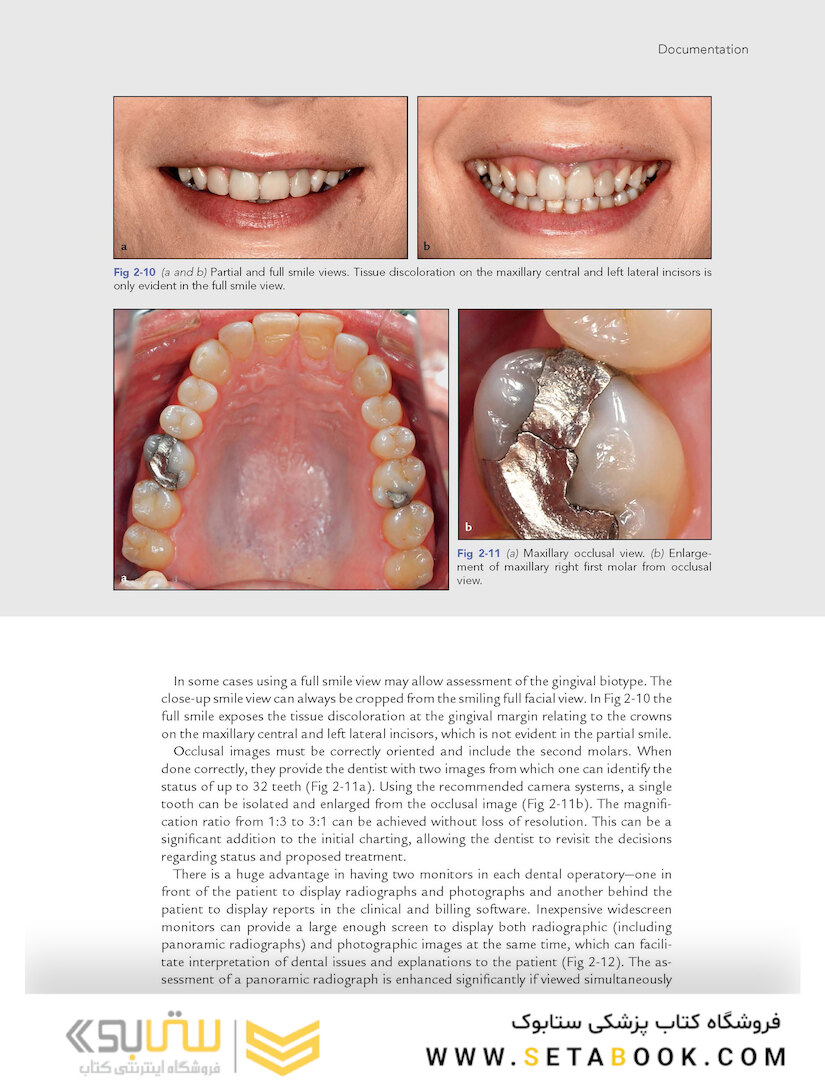 Clinical Photography in Dentistry 1st Edition 2019