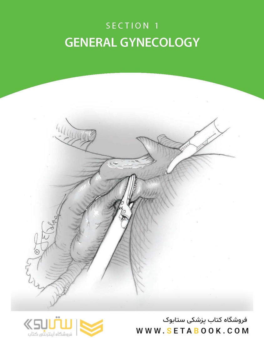 Williams Gynecology, 4th Edition2020