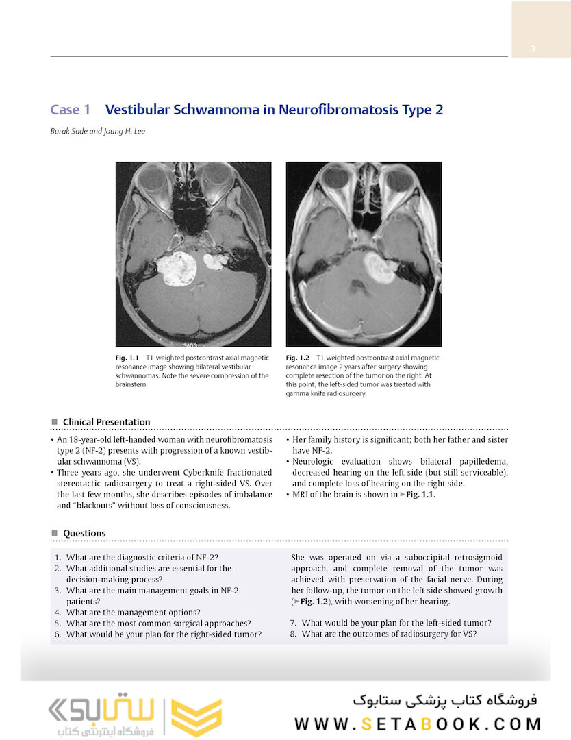 Neurosurgery Case Review: Questions and Answers 2nd Edition 2020