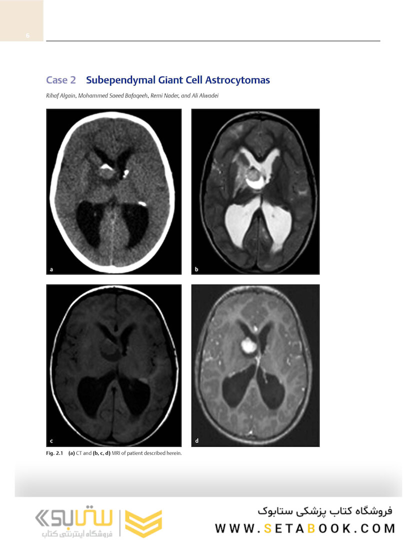 Neurosurgery Case Review: Questions and Answers 2nd Edition 2020