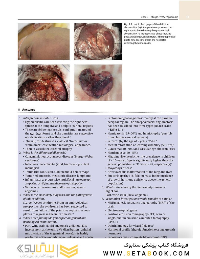 Neurosurgery Case Review: Questions and Answers 2nd Edition 2020
