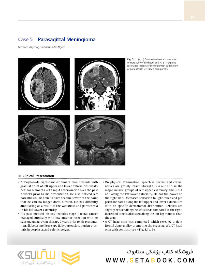 Neurosurgery Case Review: Questions and Answers 2nd Edition 2020
