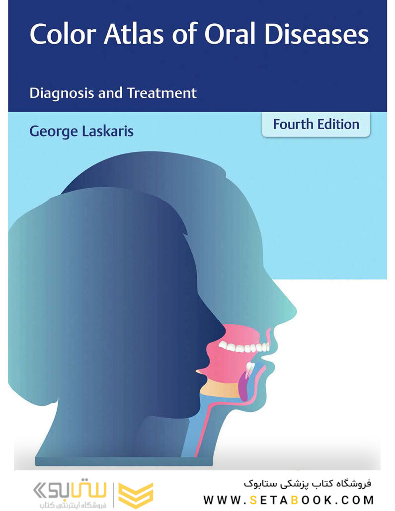 Color Atlas of Oral Diseases: Diagnosis and Treatment 4th Edicion 2017