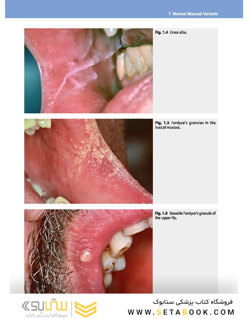 Color Atlas of Oral Diseases: Diagnosis and Treatment 4th Edicion 2017