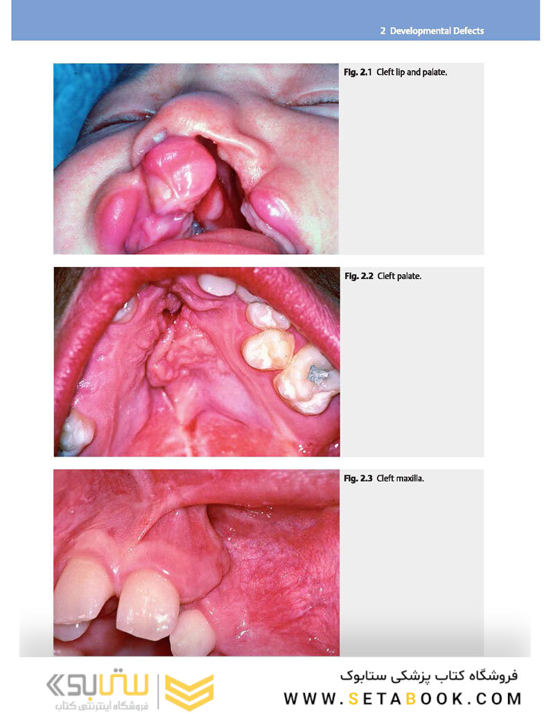 Color Atlas of Oral Diseases: Diagnosis and Treatment 4th Edicion 2017