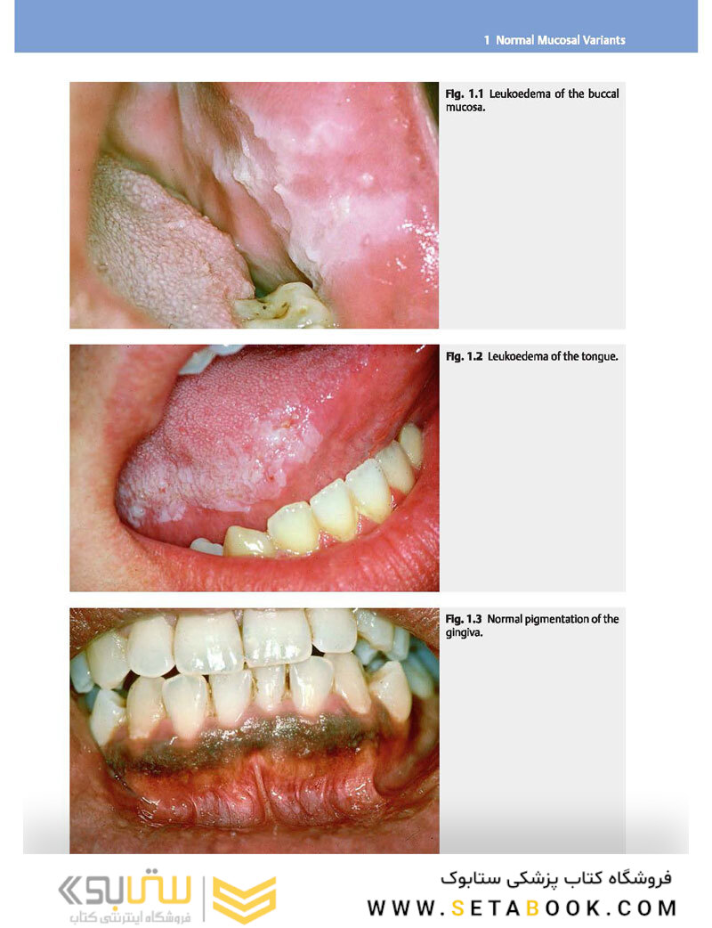 Color Atlas of Oral Diseases: Diagnosis and Treatment 4th Edicion 2017