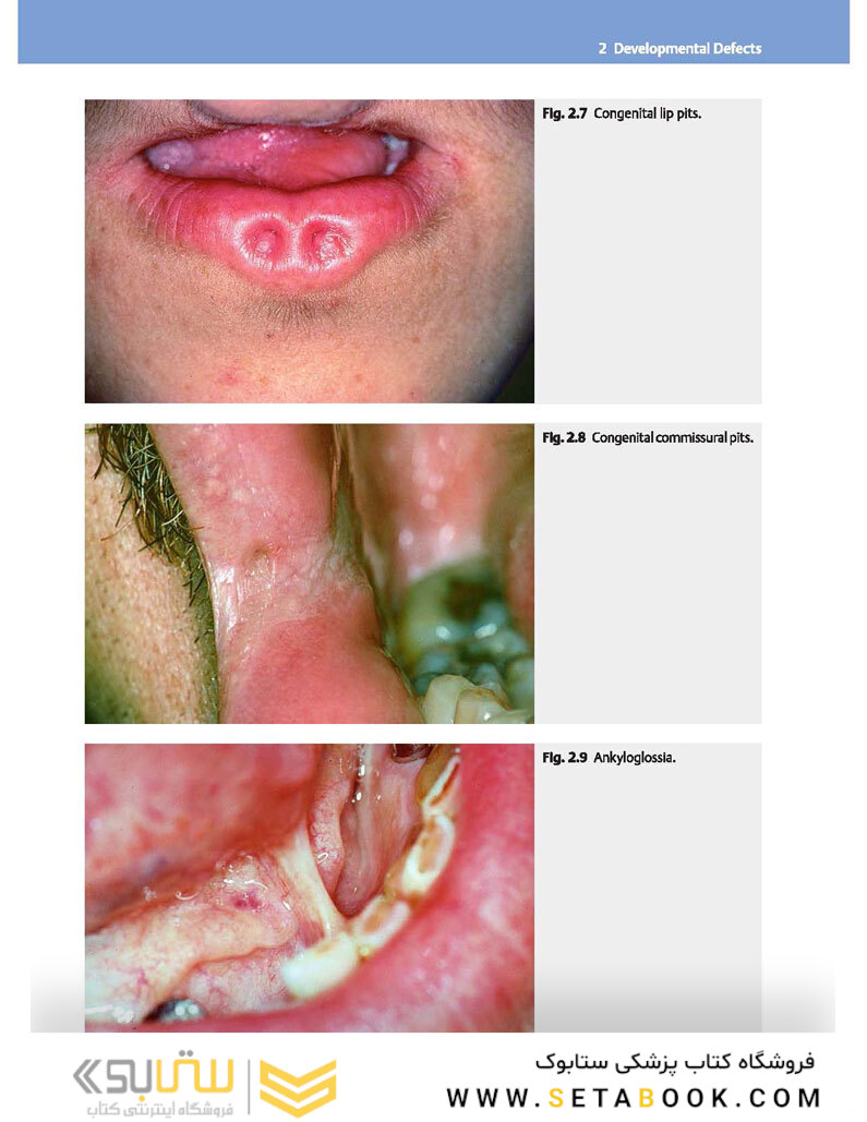 Color Atlas of Oral Diseases: Diagnosis and Treatment 4th Edicion 2017