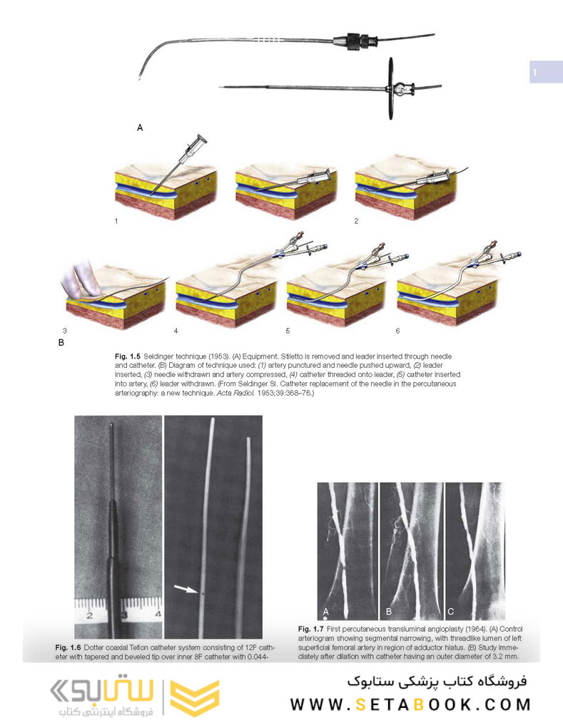 Image-Guided Interventions, 3rd Edition2020