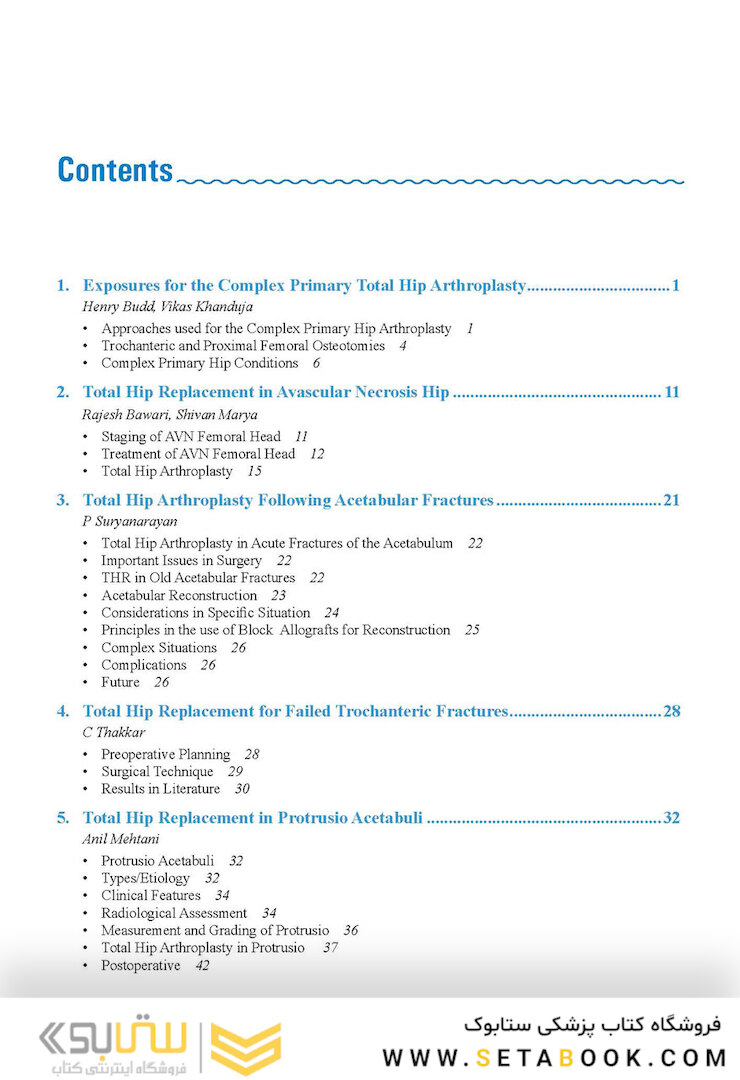 Complex Primary Total Hip Replacement 1st Edition