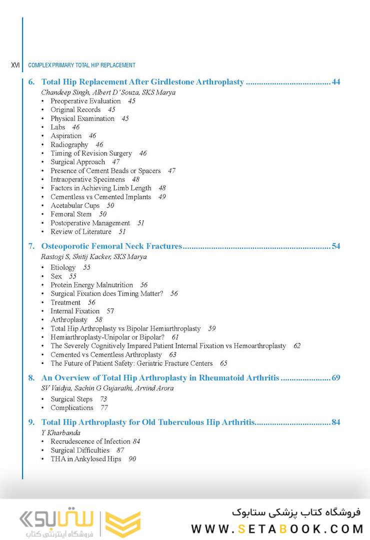 Complex Primary Total Hip Replacement 1st Edition